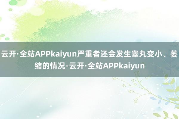 云开·全站APPkaiyun严重者还会发生睾丸变小、萎缩的情况-云开·全站APPkaiyun